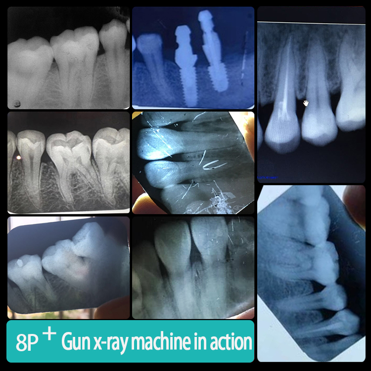 U53932820758441a4b516850f91ebf94ar 1 - High Quality Low Radiation Vet Dental Equipment Portable Digital Dental X-ray Machine Price For Veterinary Hospital
